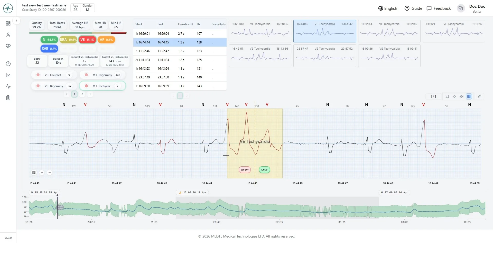 AI-Heart ECG analysis dashboard